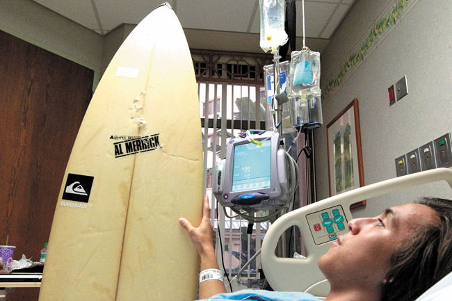 Nineteen-year-old Kiowa Gatewood examines bite marks on his surfboard as he lies in his hospital bed after surgery to his left leg at Queen's Medical Center July 30. Gatewood was attacked by a 9- to 12-foot tiger shark while surfing at White Plains Beach approximately 20 yards from shore. Jamm Aquino / ‘Honolulu Star-Advertiser’ photo 